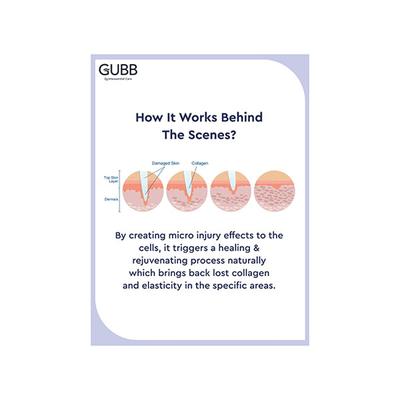 Gubb Derma Roller 0.5 Needle Grey 160 gm - Derma Rollers