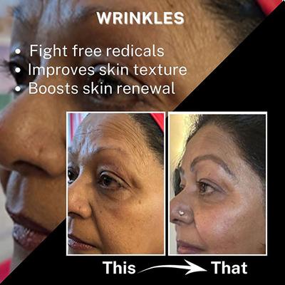 House of Beauty Multivitamin Nourish Night Cream with Revinage For Pigmented Ageing Skin 100ml - Night Cream