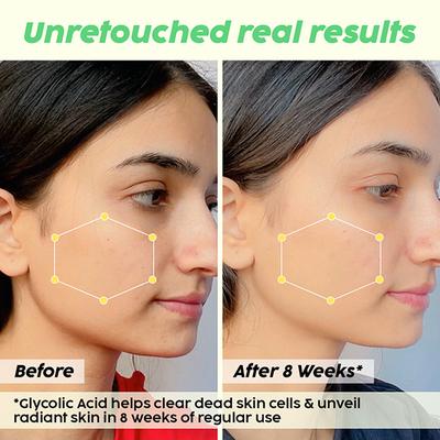 Plix The Plant Fix Guava Brightening Serum , With 3% Glycolic Acid & Vitamin C 30 ml - Face Serum