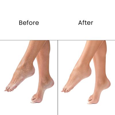 O3+ Pedilogix Scoop Bomb Pedicure with Bath Bomb for Soft & Moisturised Feet -100g+10ml 110 g - Scrubs & Exfoliants