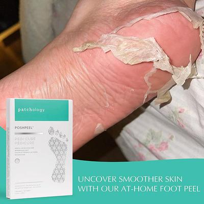 Patchology Poshpeel Pedi Cure 2's - Others