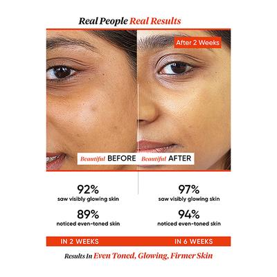 Dot & Key 20% Vitamin C Face Serum (Freshly Made) with pure L-Ascorbic Acid 25 ml - Face Serum