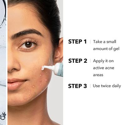 Novology 0.1% Thymol + Terpineol Acne Spot Corrector Gel 30 gm - Face Moisturizers