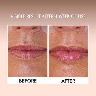 Aravi Organic Coffee Lip Lightening Scrub Balm For Dark,Chapped and Pigmented Lips 15 gm - Lip Scrubs