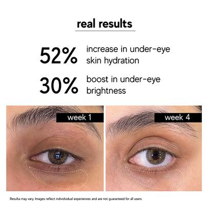 Inde wild Luminary Eye Concentrate - Dark Circles Reduction Eye Cream with and Niacinamide 15 ml - Under Eye Creams & Serums