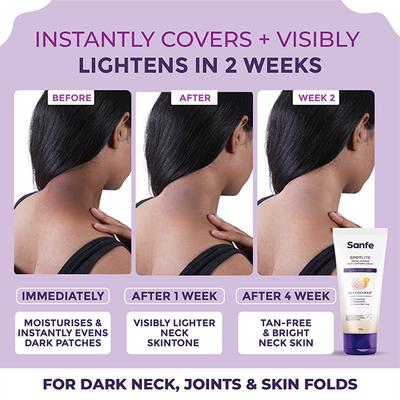 Sanfe Spotlite Insta-Cover Body Lightening Cream for Dark Neck, Joints and Skinfolds Lightens Skin 50 gm - Lotions & Creams