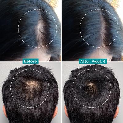 Pilgrim Redensyl and Anagain Advanced Hair Growth Serum 30 ml - Hair Serums