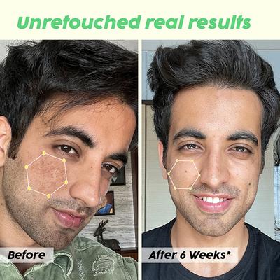 Plix The Plant Fix 10% Niacinamide Jamun Face Serum For Acne Marks & Scars For Unisex 30 ml - Face Serum