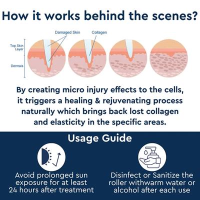 Gubb Derma Roller - Pink 540 Needles 0.5mm 1's - Derma Rollers