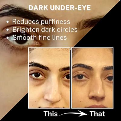 House of Beauty Under Eye Serum For Dark Circles & Hydrating Undereyes with Niacin & Vit-C 15ml - Under Eye Creams & Serums