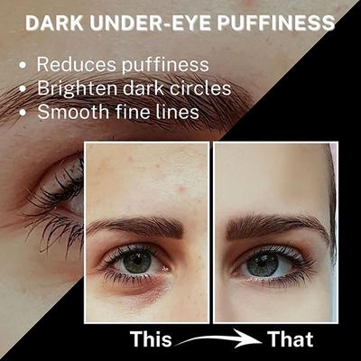 House of Beauty Instant Filler Hyaluronic Undereye Patches For Dark Circles & Plumping (2 Pairs) 2's - Dark Circle & Wrinkle Busters