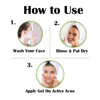 Vigini Natural Actives Acne Pitscar Face Gel 20 ml - Face Gels