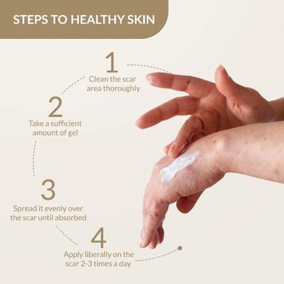 Fixderma Kelocepa Silicone Gel 25 ml - Face Gels