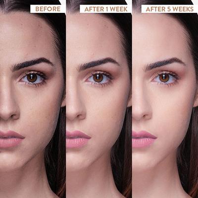 Belora Paris Red algae skin repair mask 100 gm - Face Packs