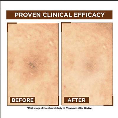 Garnier Bright Complete Night Vitamin C Serum with 10% Vitamin C for Bright Skin 15 ml - Face Serum