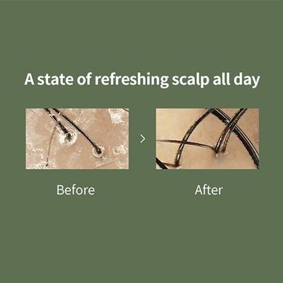 Lador Scalp Scaling Spa 15 gm - Hair Masks & Packs