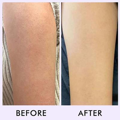 Mcaffeine Blueberry Breeze Body Scrub 175 gm - Scrubs & Exfoliants