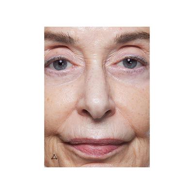 Allies Of Skin Multi Nutrient Dioic Renewing Cream 50 ml - Face Moisturizers