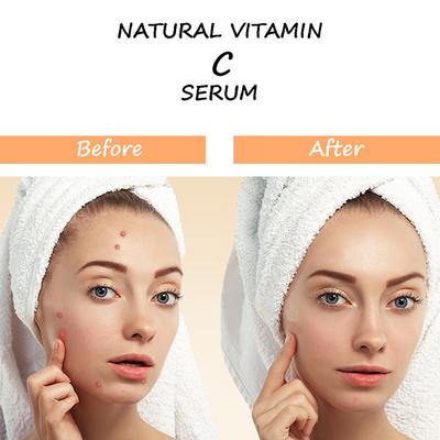 Swosh Natural Vitamin C Facial Serum 30 ml - Personal Care (Ayush)