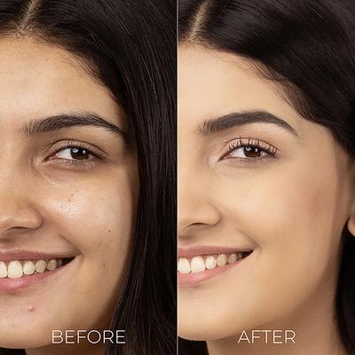 Brillare Salicylic Acid Liquid Moisturiser for Clear, Purified, Acne Prone Skin 30 ml - Lotions & Creams