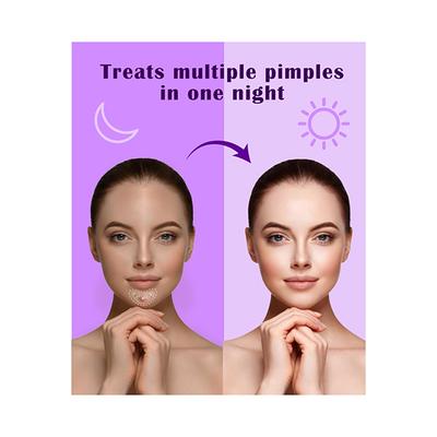 Urban Yog Acne Pimple Patch Invisible Facial Stickers Cover With Pimple Acne Absorbing Patch 1's - Masks & Peels