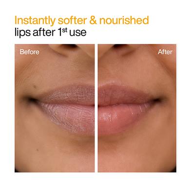 Wishcare Natural Ceramide Lip Balm for Dark Pigmented Lips with SPF50 PA+++ Heals Chapped Lips (5gm) - Lip Balms