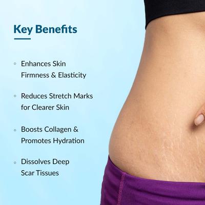 Fixderma Strallium Stretch Mark Cream 75 gm - Stretch Mark Cream