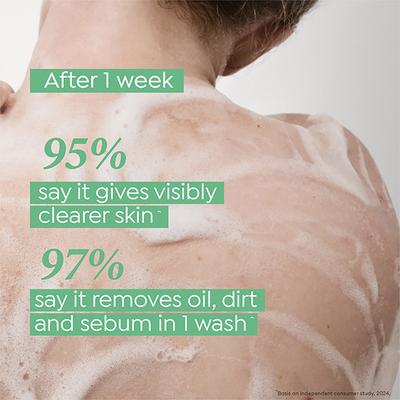 Dove 1% Salicylic Acid Formula Acne Clear Serum Body Wash, 300 ml - Shower Gels & Body Wash