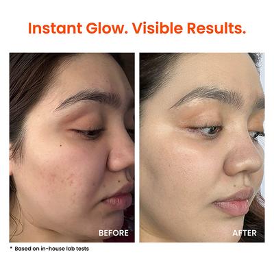 Foxtale Super Glow Moisturiser with 4% VitC-Niacinamide Complex for Brighter Skin 50ml - Face Moisturizers
