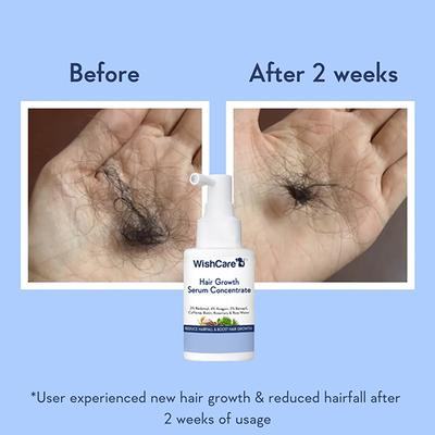 WishCare Hair Growth Serum Concentrate - 3% Resdensyl 4% Anagain 2% Baicapil Caffeine Biotin Plant Keratin & Rice Water 30 ml - Hair Serums