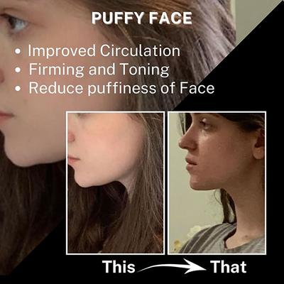 House of Beauty 24K Face Massager Kit For Undereye Puffiness, Dark Circles,Face Tightening (3Pc) 1's - Massagers