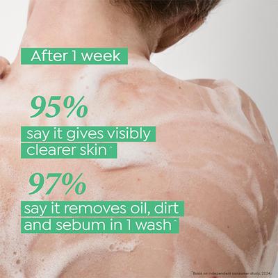 Dove 1% Salicylic Acid Formula Acne Clear Serum Body Wash, 300 ml - Shower Gels & Body Wash