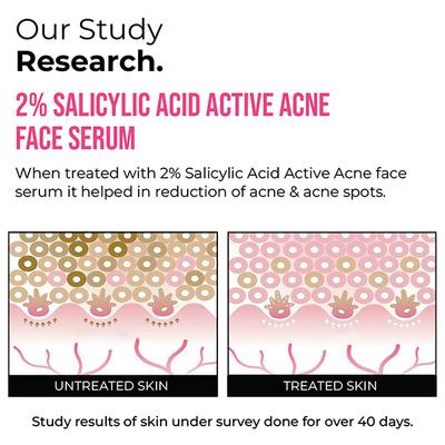 Insight Cosmetics 2% Salicylic Acid Active Acne Face Serum 30 ml - Face Serum