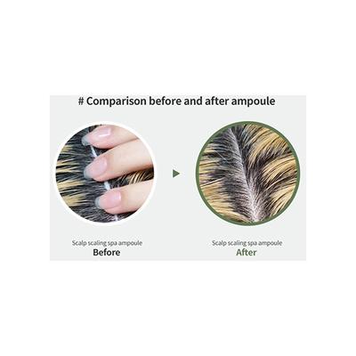 Lador Scalp Scaling Spa 15 gm - Hair Masks & Packs