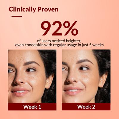 Fixderma Tranexamic Acid + 2% Kojic Acid + 1% Arbutin SKARFIX -TX Face Cream for Pigmentation 30 gm - Face Creams