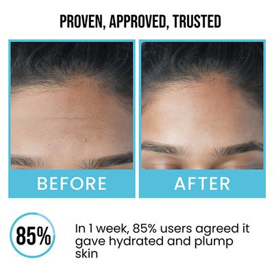 Insight Cosmetics 2% Hyaluronic Acid + 2% Alpha Arbutin Face Serum 30 ml - Face Serum
