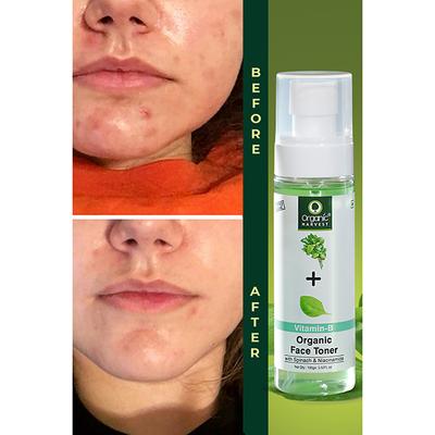 Organic Harvest Organic Face Toner with Spinach and Niacinamide Acne 100ml - Toners