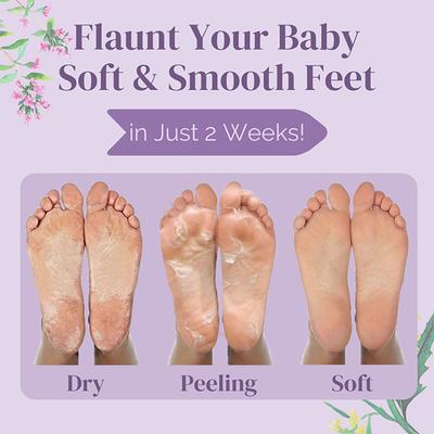 Luxa Derme Peeling & Exfoliating Foot Mask 40 ml - Foot Creams & Lotions