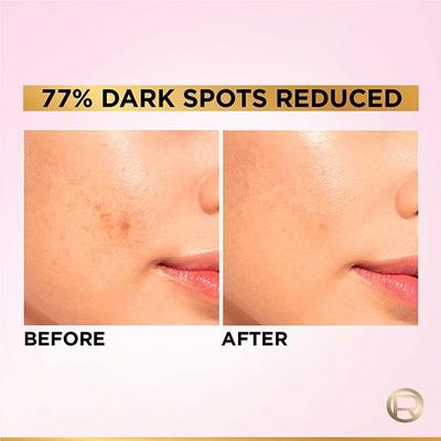 L'Oreal Paris Glycolic Bright Instant Glowing Serum 8% Glycolic Acid 30 ml - Under Eye Creams & Serums