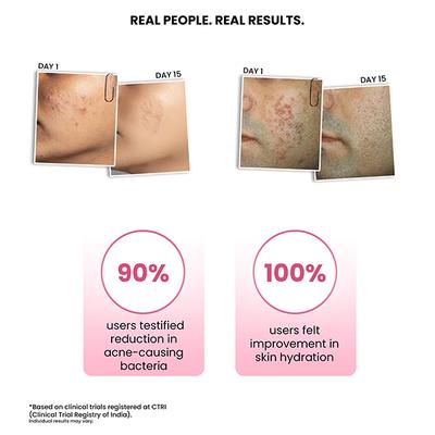 ThriveCo Goodbye Acne Kit (Serum + Face Wash), Reduces Acne, Pimples, Acne Marks & Sebum 1's - Facial Kits