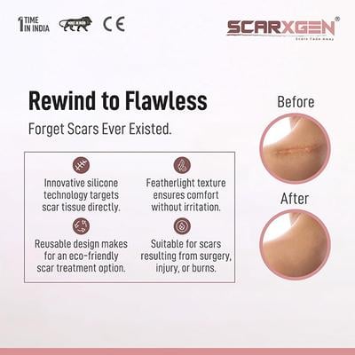 Scarxgen Silicone Gel Sheet (5 cm X 5 cm) 1's - Bandages