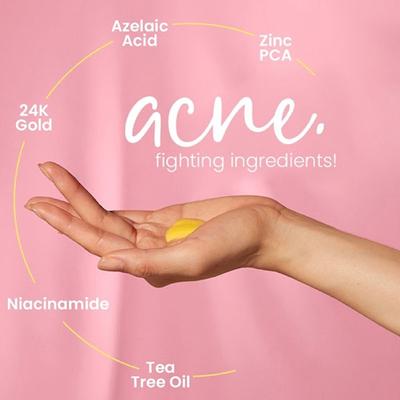 Anveya Goodbye Acne Serum With Niacinamide, Azelaic Acid & Hyaluronic Acid 30 ml - Face Serum