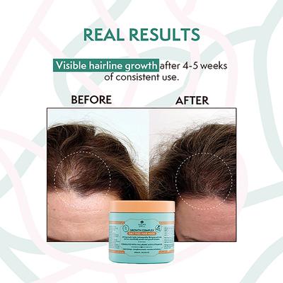 Nature Spell Growth Complex Hair Mask - Sulphate Free 400 ml - Hair Masks & Packs