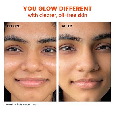 Foxtale SPF 70 Gel-Cream Sunscreen for Oily Skin with PA ++++ & Niacinamide 50ml - Face Sunscreen