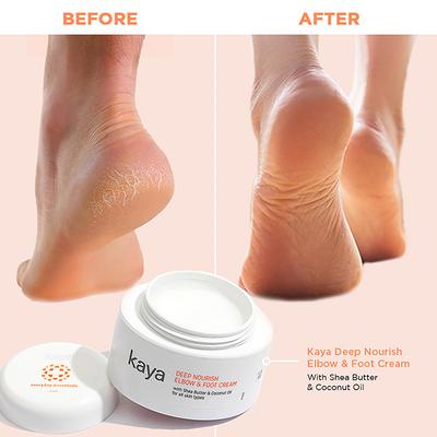 Kaya Deep Nourish Elbow and Foot Cream 50gm - Foot Creams & Lotions