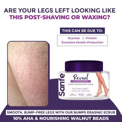 Sanfe Bumps Erasing Body Scrub for Rough Bumpy Skin Tan Strawberry Legs Remove Dirt, Dead Skin 100 gm - Creams, Lotions & Oils