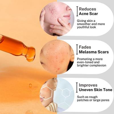 House of Beauty Pigmentation Oil For Pigmented Skin, Reduces Melanin, Uneven Skin Tone 30ml - Face Oils