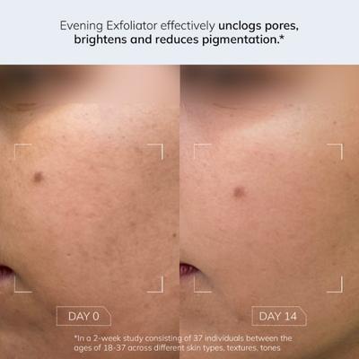 FAE Beauty Evening Exfoliator - Gentle Bi-Phasic Exfoliating Toner 100 ml - Face Mists