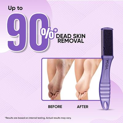Vega Portable Pedicure Foot File For Cracked Heels, Dead Skin & Callus Removal, (Pd-03N) - Manicure & Pedicure Kits