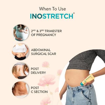 Inostretch Intensive Scar and Anti Stretch Mark Cream 60 gm - Skin-Treatment